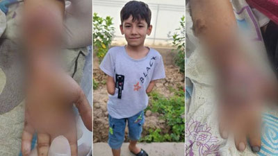 'Qashqadaryoda xavfsizligi ta`minlanmagan transformator sabab 7 yoshli bola ikki qo`lidan ajralib qoldi'ning rasmi