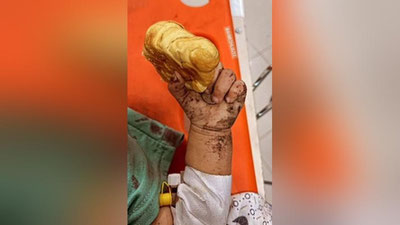 'Ғазо секторидаги шифохонага зарба берилди (видео)'ning rasmi