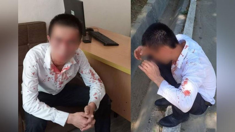 'Toshkentda o`qituvchini kaltaklaganlarga jinoiy ish ochildi'ning rasmi