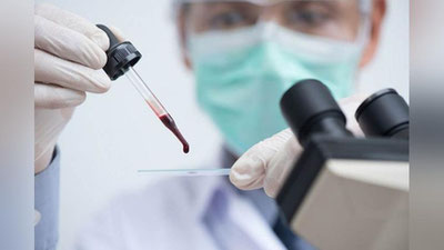 '​Yoz mavsumida qon quyuqlashishi qanchalik xavfli?'ning rasmi