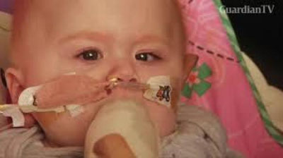 'Yuragi tashqarida bo`lgan go`dak 10 oydan beri yashab kelmoqda'ning rasmi