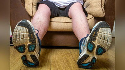 'Bahaybat oyoqlar shotlandiyalikni ishsiz qoldirmoqda 'ning rasmi