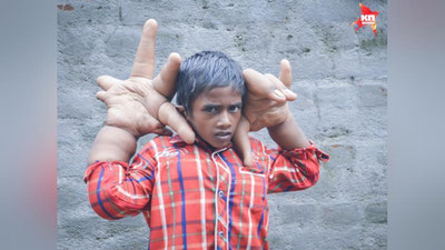 'ULKAN QO`LLI BOLAKAY'ning rasmi