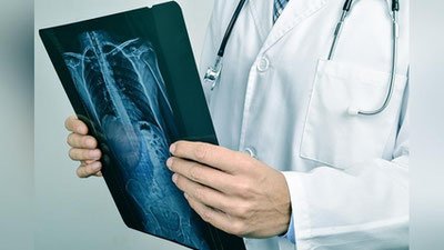 'Umurtqa deformasiyalarini xirurgik davolash uchun qurilma yaratildi'ning rasmi