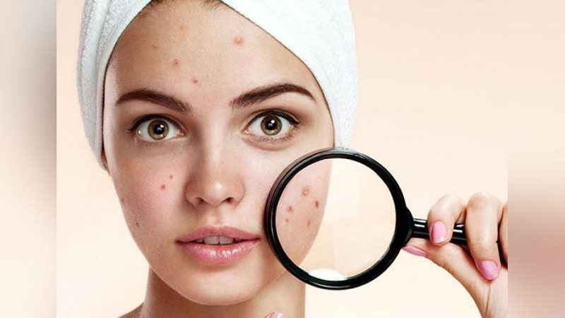 'HUSNBUZARGA SABAB STRESSMI? 7 AFSONAGA OYDINLIK KIRITAMIZ 'ning rasmi