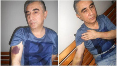 '​Toshkent shahar IIBB tadbirkor kaltaklangani haqidagi xabarni rad etdi'ning rasmi