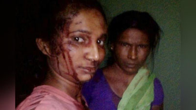 'Ҳиндистонлик қиз калтак билан йўлбарсга ҳужум қилди'ning rasmi