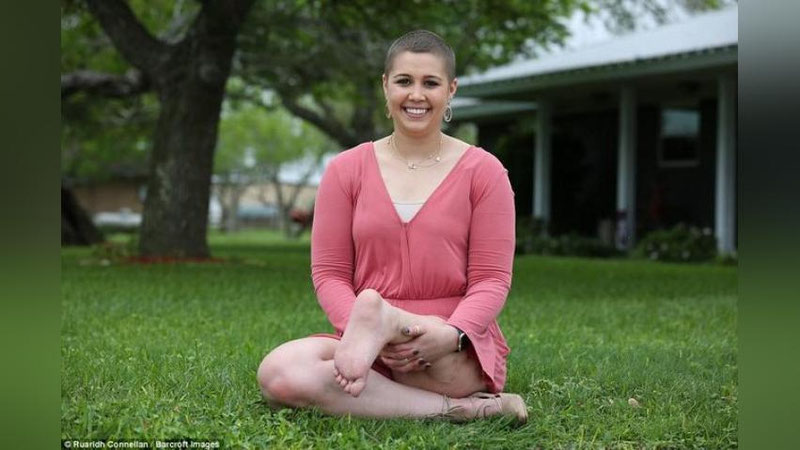 'SUYaK SARATONI TUFAYLI 20 YoShLI QIZNING TIZZASI O`RNIGA BOLDIRI TIKIB QO`YILDI'ning rasmi