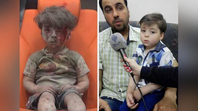 'Сурати бутун дунёга ларзага солган алепполик боланинг бугунги ҳаёти'ning rasmi