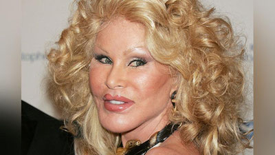 '“Мушук аёл” пластик операция ҳақидаги миш-мишларни рад этди'ning rasmi