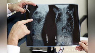 '11 oylik chaqaloqqa suiqasd qilinganmi?'ning rasmi