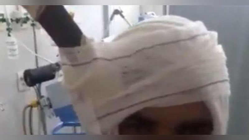 'Boshiga pichoq sanchilgan jinoyatchi og`riqni sezmadi (Video)'ning rasmi