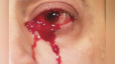 'Italiyalik erkak birdaniga qonli ko`z yosh to`ka boshladi 'ning rasmi