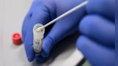 'Ўзбекистонда коронавирусга бир кунда ўртача 10 мингта ПЗР-тест топширилмоқда — ССВ'ning rasmi