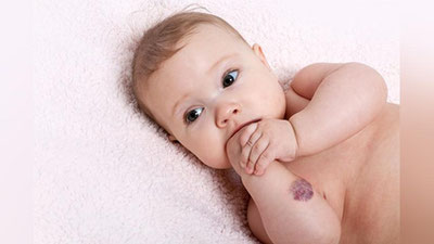 'Shifokorlar bolalar orasida yangi virus keng tarqalayotgani haqida xabar berdi'ning rasmi