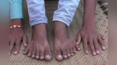 '6 barmoqli bolani ota-onasi ma`budlarga qurbonlik qilmoqchi bo`ldi 'ning rasmi