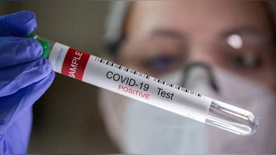 Изрображение '«Невидимый» субвариант коронавируса зарегистрирован в Узбекистане'