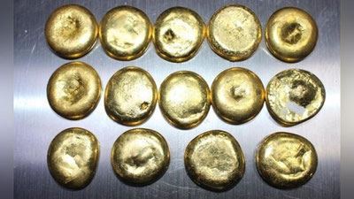 Изрображение 'В аэропорту Ташкента задержали мужчину, перевозившего в своем теле полкило золота'