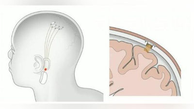 Изрображение 'Илон Маск научился вживлять компьютер в человеческий мозг'