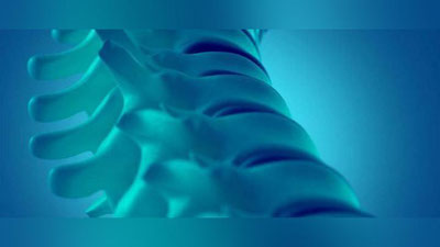 'Сунъий умуртқа миллионлаб беморларни даволайди'ning rasmi