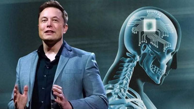 'Ilon Mask kompaniyasi ilk bor inson miyasiga chip o`rnatdi'ning rasmi