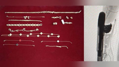 Изрображение 'Пассажир рейса “Стамбул-Ташкент” пытался ввезти ювелирные изделия в протезе руки'