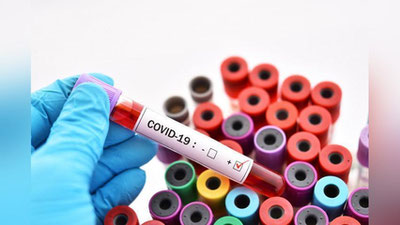 'O`zbekistonda koronavirusga qaysi yosh toifasi ko`proq chalinmoqda?'ning rasmi