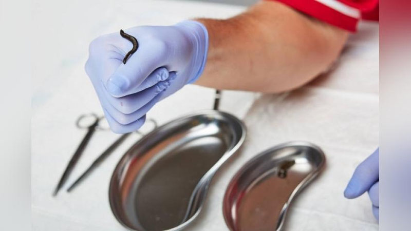 'Shifo maslahat: “ZULUKLARNING QANDAY FOYDASI BOR?”'ning rasmi