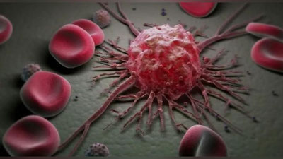 Изрображение 'НАЗВАНЫ ПРОДУКТЫ, ПРОВОЦИРУЮЩИЕ РАК КИШЕЧНИКА'