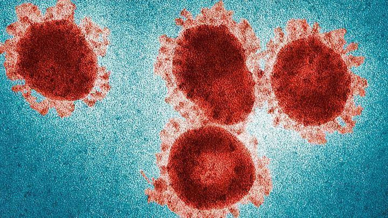 'O`zbek  blogeri koronavirusga test topshirishda muammolarga duch kelayotganini aytdi'ning rasmi
