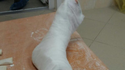 Изрображение 'В ТАШКЕНТЕ ХУЛИГАН СЛОМАЛ НОГУ ПРИ ПОПЫТКЕ БЕГСТВА ИЗ ЮНУСАБАДСКОГО ОВД'