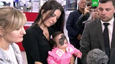 Изрображение 'Российские врачи провели первую операцию "девочке-бэтмену" из США (видео)'