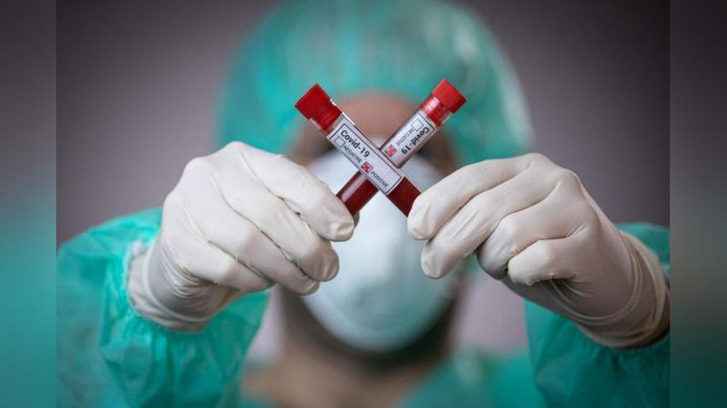 'Yana 8 nafar fuqaroda koronavirus aniqlandi'ning rasmi