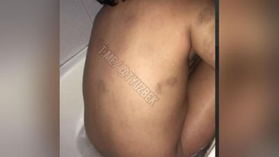 'Yashnobod tumanidagi 103-sonli internat-maktabi tarbiyalanuvchisi kaltaklandi. Prokuratura vaziyatni o`rganmoqda (video)'ning rasmi