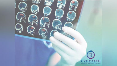Изрображение 'Разработку, способную распознать инсульт в первые 4 часа, могут внедрить в Узбекистане'