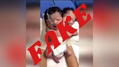 Изрображение 'Минздрав опроверг рождение двухголовых близнецов в Узбекистане'