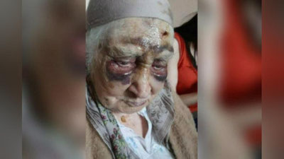 'Toshkentda 87 yoshli ayolning qizi va nabirasi tomonidan ayovsiz kaltaklangani bo`yicha qo`shimcha tafsilotlar ma`lum qilindi'ning rasmi