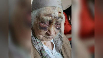 'Toshkentda 87 yoshli onaxon o`z qizi va nevarasi tomonidan muntazam urib, qiynab kelingan'ning rasmi
