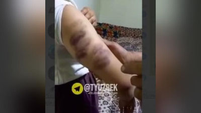 'Бухорода 8-синф ўқувчиси мактаб директори томонидан аёвсиз калтакланди(видео)'ning rasmi