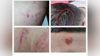 '"Севимли" телеканали ходими ИИО ходимлари томонидан калтаклангани айтилмоқда'ning rasmi