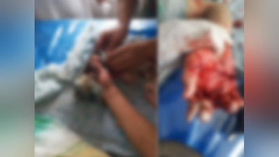 'Andijonda 16 yoshli bolaning qo`li go`sht maydalagich ichiga kirib ketdi'ning rasmi