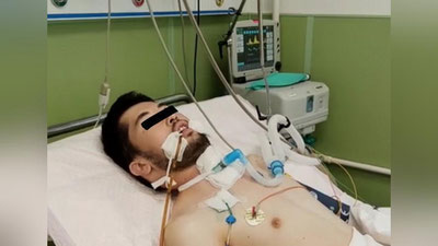 'Rossiyaga ishlashga borgan 22 yoshli surxondaryolik yigit 2 qavatdan yiqilib, og`ir tan jarohati oldi'ning rasmi