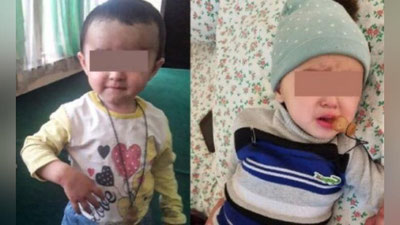 'Qashqadaryoda 2 yoshli qizaloq noto`g`ri emlangandan falaj bo`lib qoldimi?'ning rasmi