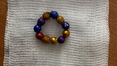 'Qozog`istonda ikki yashar bola 11 ta magnit yutib yubordi'ning rasmi