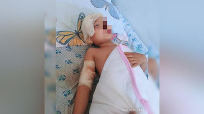 'Андижонда ҳам ёш болани итлар талаб, тишлади'ning rasmi