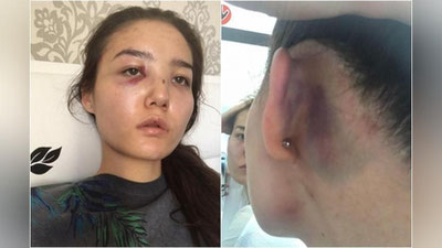 Изрображение 'МИД Казахстана отозвал из ОАЭ дипломата, чья супруга пожаловалась на избиение'