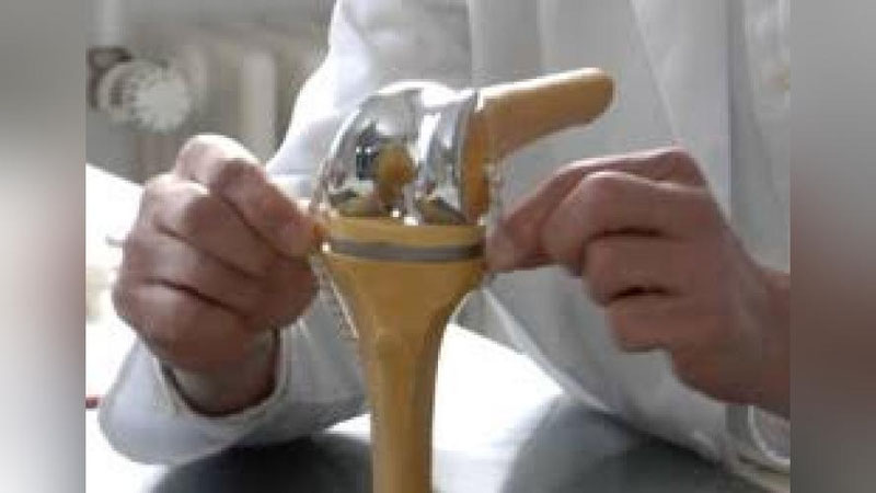 'SOXTA BO`G`IN QO`YIShDA IMTIYoZLAR BORMI?'ning rasmi