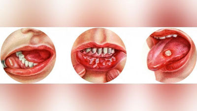 '“YaNA STOMATIT BO`LDIM...”'ning rasmi