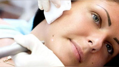 'Shifo maslahat: "YuZIMDAGI XOLNI OLDIRSAM BO`LADIMI?"'ning rasmi