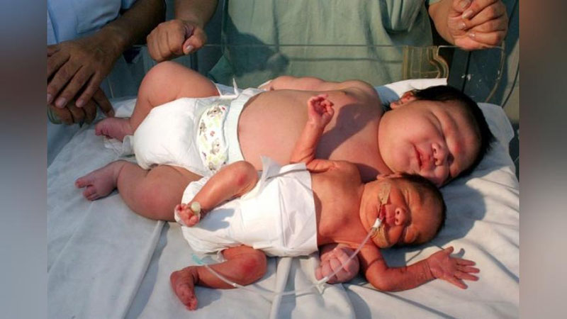 'Tojikistonda 7,2 kilogrammlik chaqaloq tug`ildi. Ammo rekord emas'ning rasmi